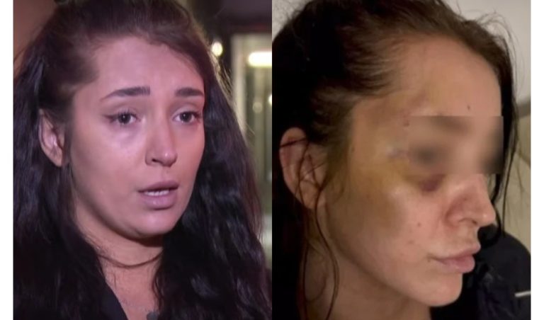 Goraždanka Adna Borovac brutalno pretučena, policija tražila da se umije kako bi „provjerili šminku“