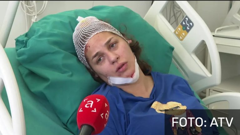 Ljubojević napravila težu nesreću službenim vozilom: Snosim svu odgovornost, popila sam par pića i gledala u telefon
