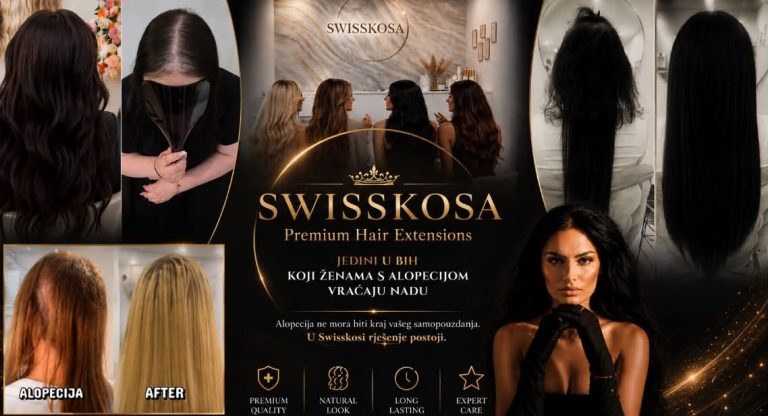 Jedini u BiH koji ženama s alopecijom vraćaju nadu – Swisskosa donosi rješenja koja vraćaju samopouzdanje i mijenja život